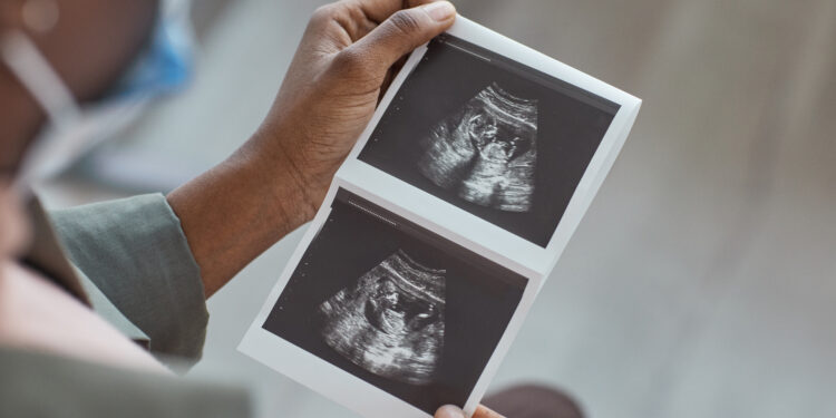 Georgia’s 6-Week Abortion Ban Reinstated by State Supreme Court